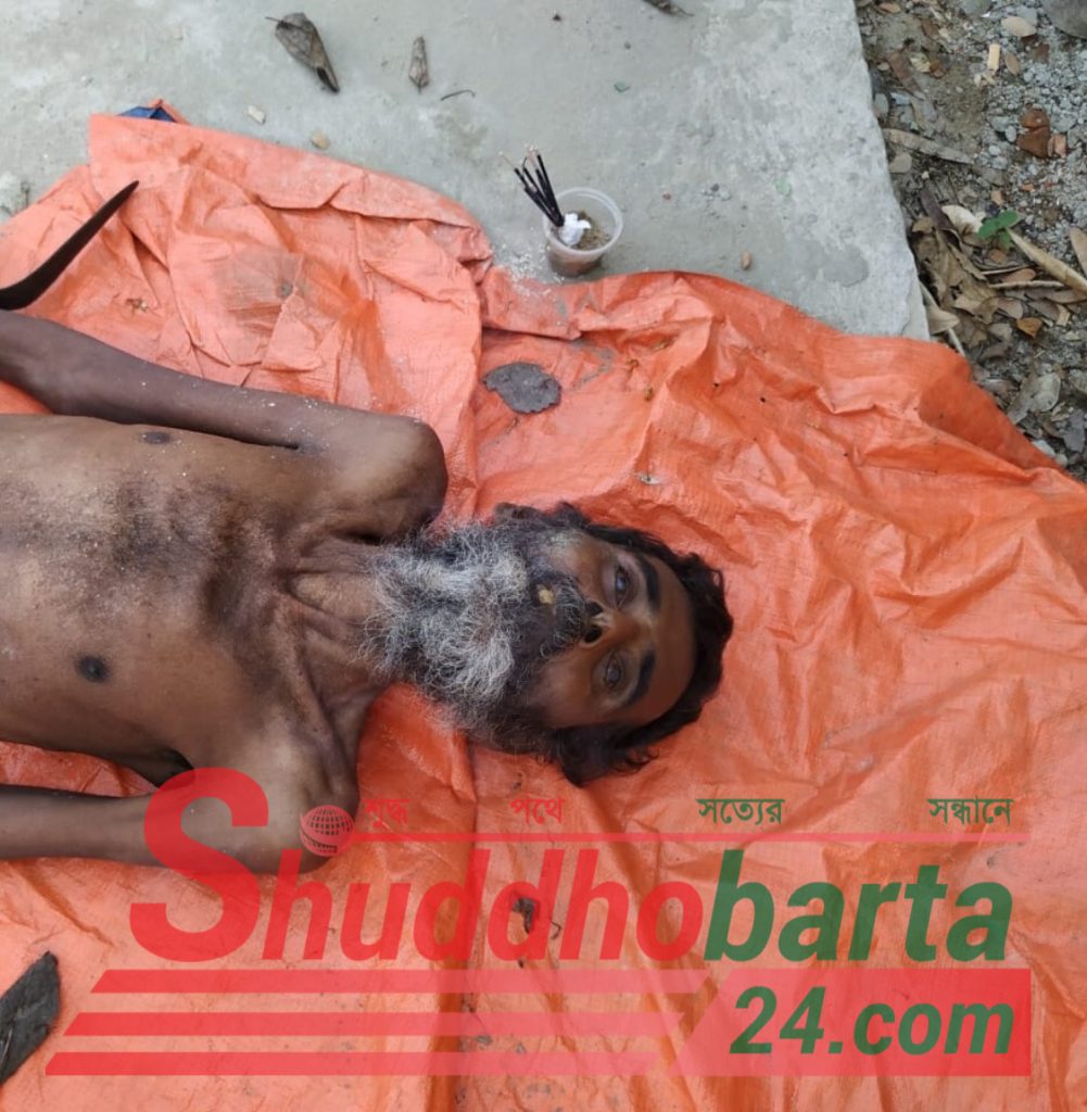 ওসমানী মেডিকেল কলেজ হাসপাতালে অজ্ঞাত এক ব্যক্তির লাশ