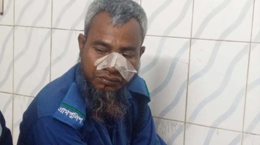 বিএনপি নেতার স্ত্রীর জন্মনিবন্ধনে দেরি, ফাটিয়ে দেওয়া হলো গ্রামপুলিশ সদস্যের নাক